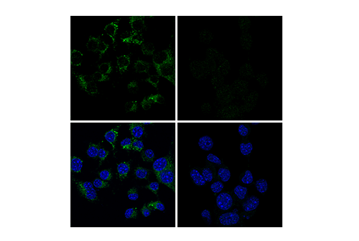 Immunofluorescence Image 1: CD68 (E3O7V) Rabbit mAb