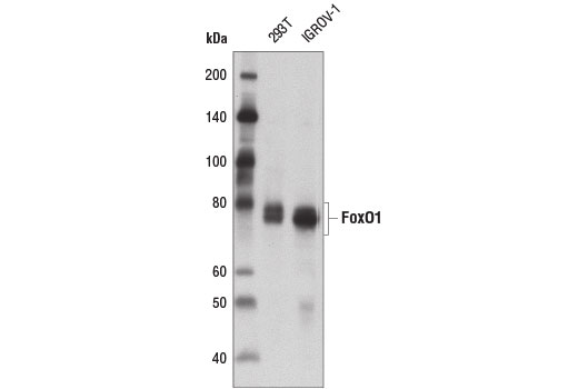 Western Blotting Image 1: FoxO1 (D7C1H) Mouse mAb