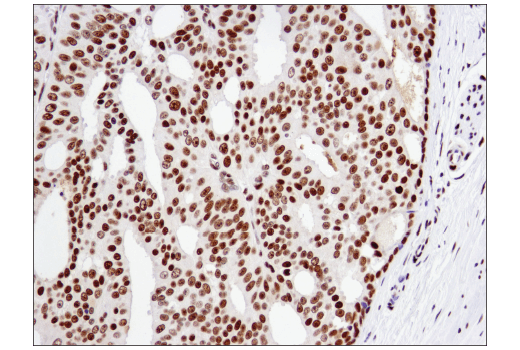 Immunohistochemistry Image 5: ATF-2 (D4L2X) XP<sup>®</sup> Rabbit mAb