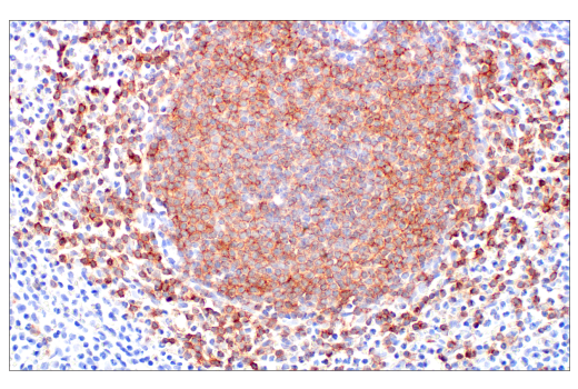 Immunohistochemistry Image 6: CD19 (Intracellular Domain) (D4V4B) XP<sup>®</sup> Rabbit mAb (BSA and Azide Free)