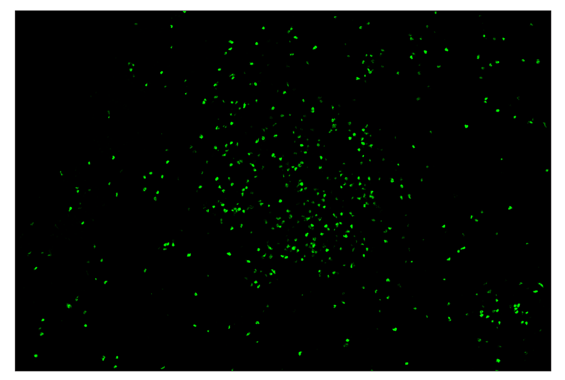 Immunohistochemistry Image 2: FoxP3 (D6O8R) & CO-0041-594 SignalStar<sup>™</sup> Oligo-Antibody Pair