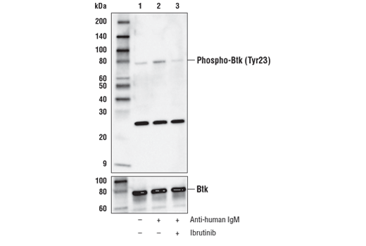 Western Blotting Image 1: Phospho-Btk (Tyr223) (D1D2Z) Rabbit mAb