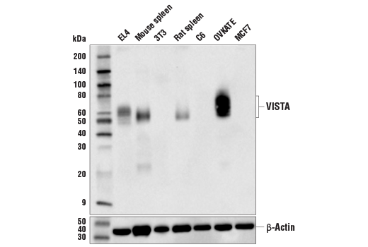 Western Blotting Image 1: VISTA (D5L5T) XP<sup>®</sup> Rabbit mAb (BSA and Azide Free)