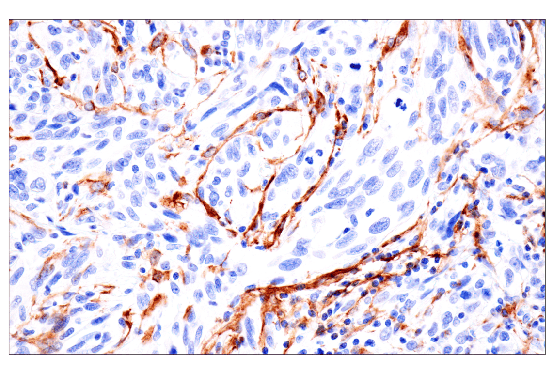 Immunohistochemistry Image 10: FAP (F1A4G) Rabbit mAb (BSA and Azide Free)