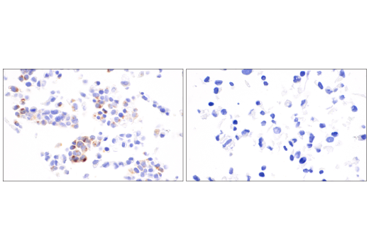 Immunohistochemistry Image 3: AFP (C3) Mouse mAb
