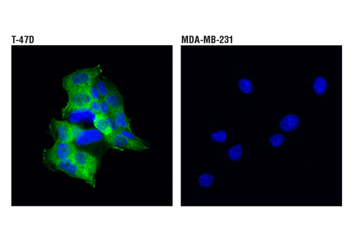 undefined Image 44: LRP1-mediated Endocytosis and Transmission of Tau Antibody Sampler Kit