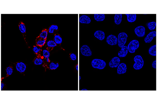 Immunofluorescence Image 1: CD68 (D4B9C) XP<sup>®</sup> Rabbit mAb (Alexa Fluor<sup>®</sup> 647 Conjugate)