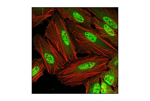 Immunofluorescence Image 1: PP2C-α (D18C10) XP<sup>®</sup> Rabbit mAb (BSA and Azide Free)