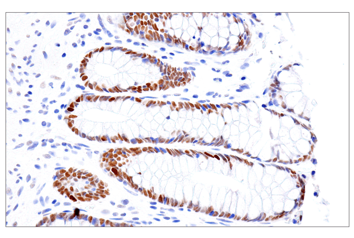 Immunohistochemistry Image 13: FoxA1/HNF3α (IHC578) Mouse mAb