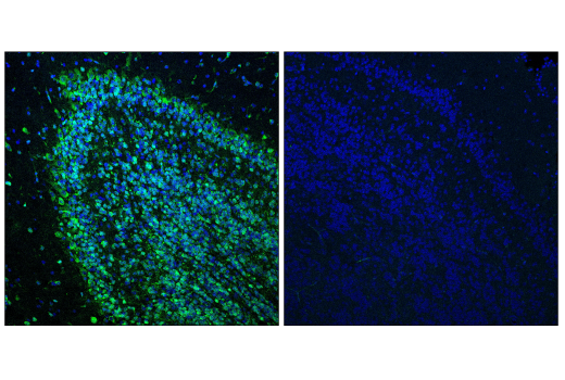 Immunofluorescence Image 1: Cas9 (<i>S. pyogenes</i>) (7A9-3A3) Mouse mAb