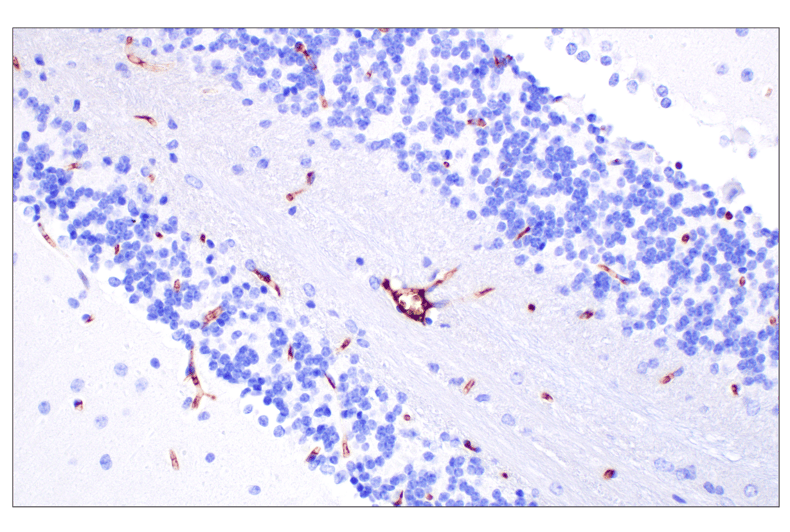 Immunohistochemistry Image 4: PNPLA3 (E7N6O) Rabbit mAb