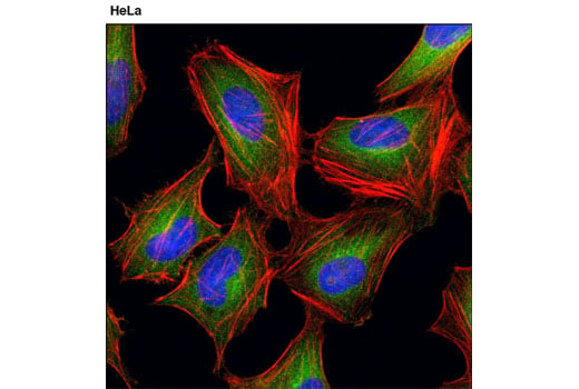 undefined Image 3: PhosphoPlus<sup>®</sup> MEK1/2 (Ser217/Ser221) Antibody Duet