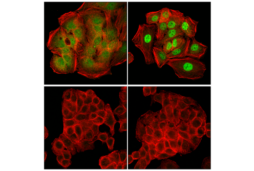 Immunofluorescence Image 1: SMAD4 (D3R4N) XP<sup>®</sup> Rabbit mAb (BSA and Azide Free)