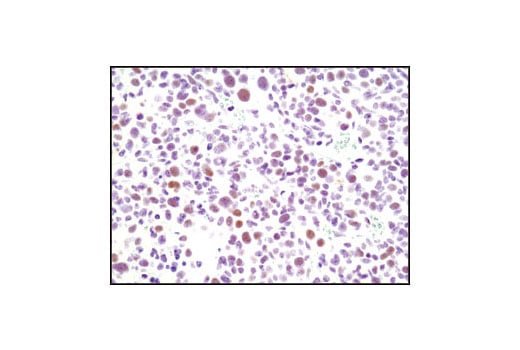 Immunohistochemistry Image 2: CDK9 (C12F7) Rabbit mAb (BSA and Azide Free)