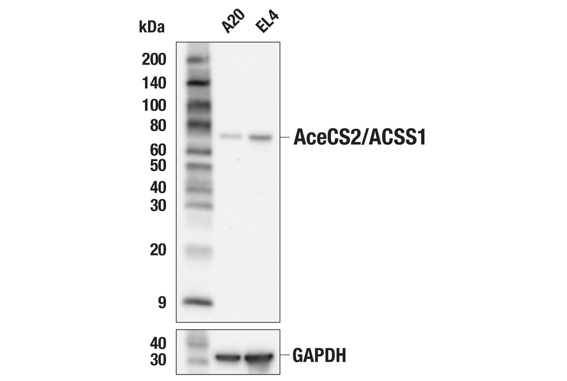 Western Blotting Image 3: AceCS2/ACSS1 (E6T5E) Rabbit mAb