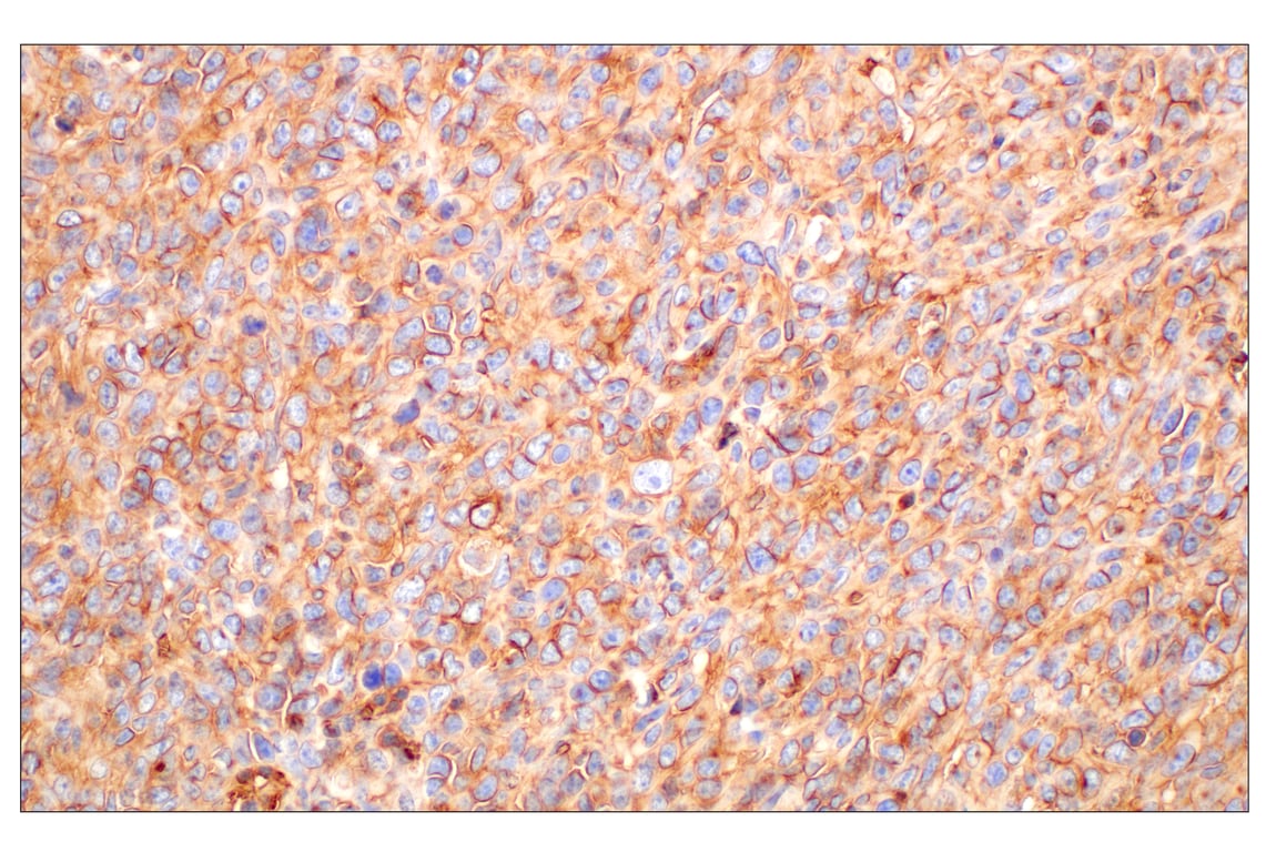 Immunohistochemistry Image 6: CD47 (E2V9V) Rabbit mAb
