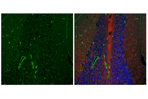 Immunofluorescence Image 1: PDGF Receptor β (28E1) Rabbit mAb