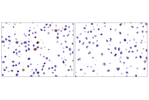 Immunohistochemistry Image 2: CD40 Ligand (D5J9Y) Rabbit mAb (BSA and Azide Free)