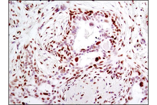 Immunohistochemistry Image 2: Histone H2A.X (D17A3) XP<sup>®</sup> Rabbit mAb (BSA and Azide Free)