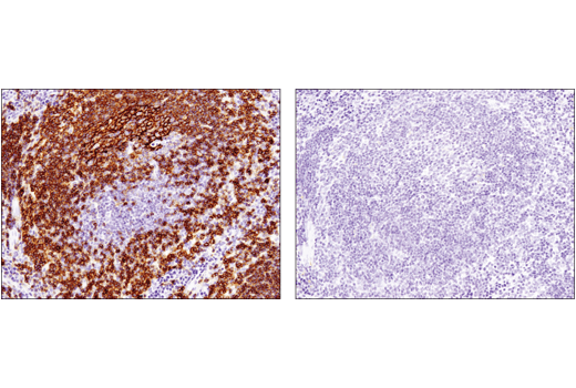 Immunohistochemistry Image 5: FcγRIIB (D8F9C) XP<sup>®</sup> Rabbit mAb