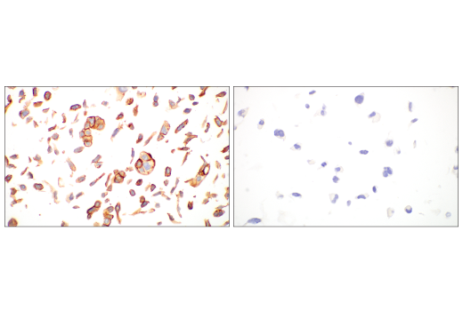 Immunohistochemistry Image 8: Integrin β6 (E4M9P) XP<sup>®</sup> Rabbit mAb