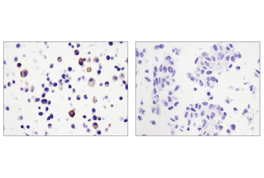 Immunohistochemistry Image 2: CD39/NTPDase 1 (E2X6B) XP<sup>®</sup> Rabbit mAb