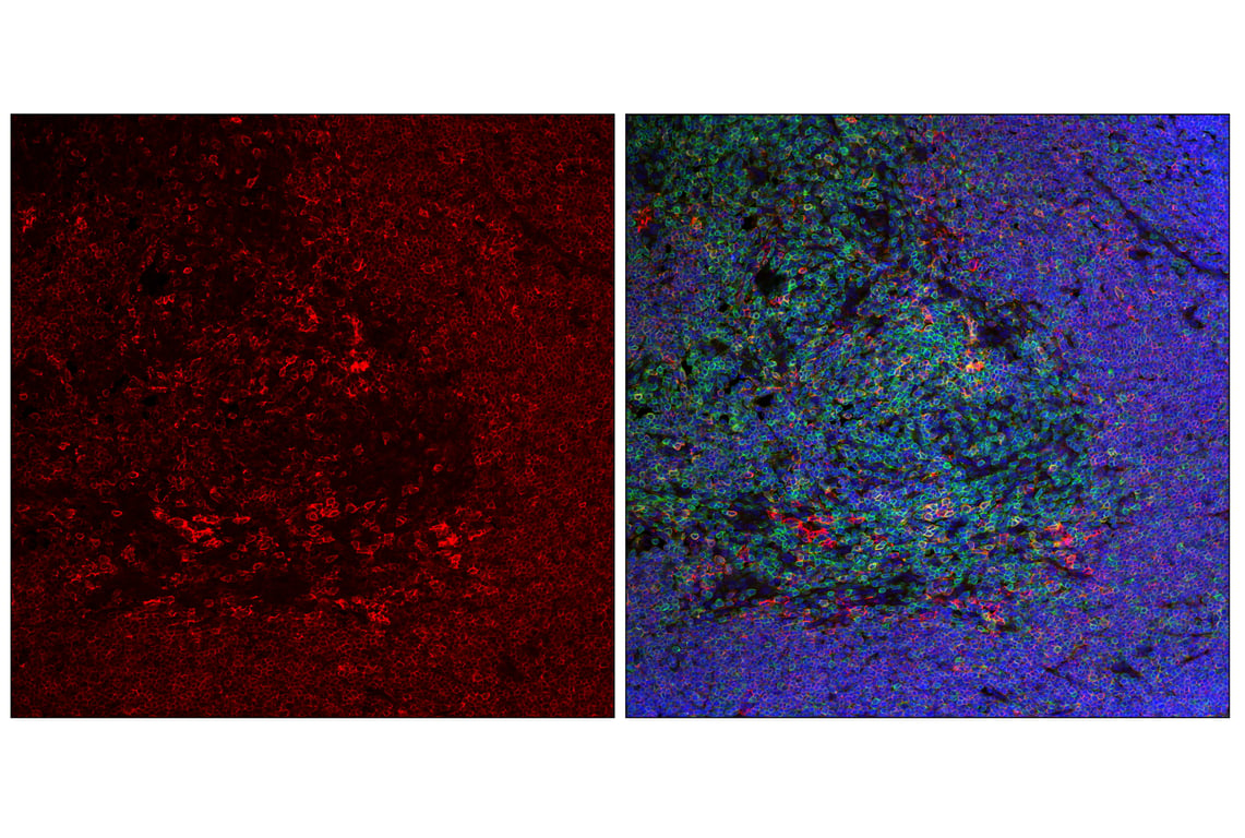 Immunofluorescence Image 2: SLAMF6/Ly108 (E2P7A) Rabbit mAb (Alexa Fluor<sup>®</sup> 647 Conjugate)