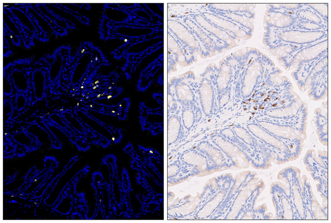 Immunohistochemistry Image 6: CD3ε (E4T1B) & CO-0048-750 SignalStar<sup>™</sup> Oligo-Antibody Pair