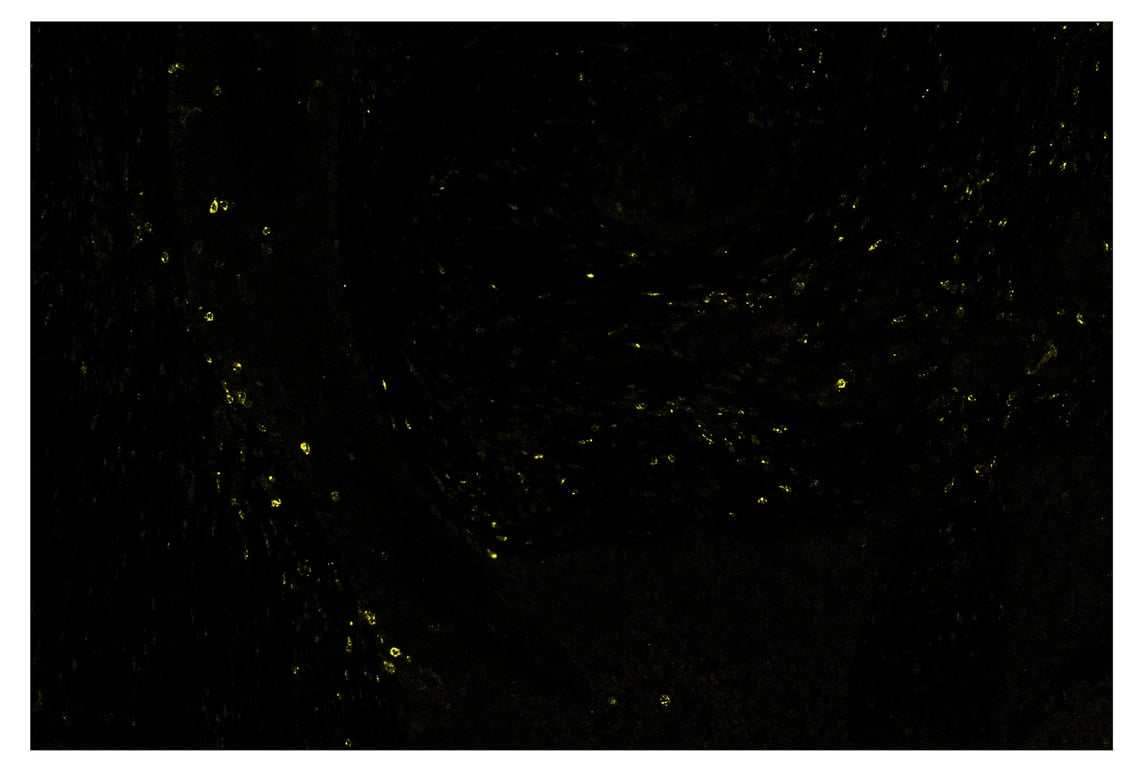 Immunohistochemistry Image 3: LAG3 (D2G4O<sup>™</sup>) & CO-0026-594 SignalStar<sup>™</sup> Oligo-Antibody Pair