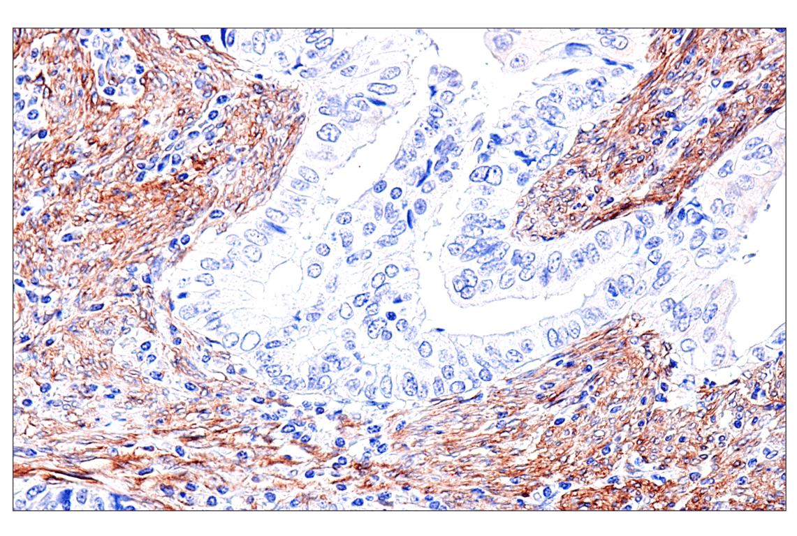 Immunohistochemistry Image 3: FAP (F1A4G) Rabbit mAb