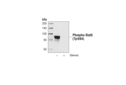 Western Blotting Image 1: Phospho-Stat5 (Tyr694) (C11C5) Rabbit mAb