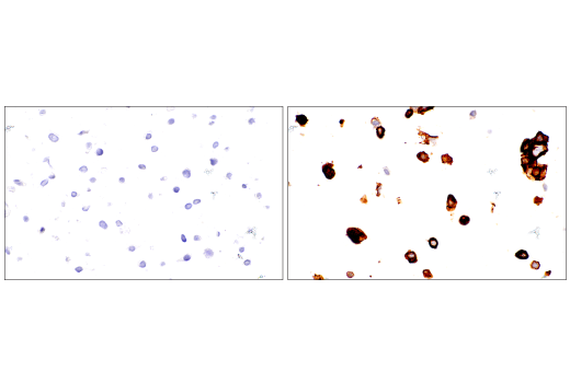 Immunohistochemistry Image 4: SARS-CoV-2 Spike Protein (S1) (E5S3V) Rabbit mAb