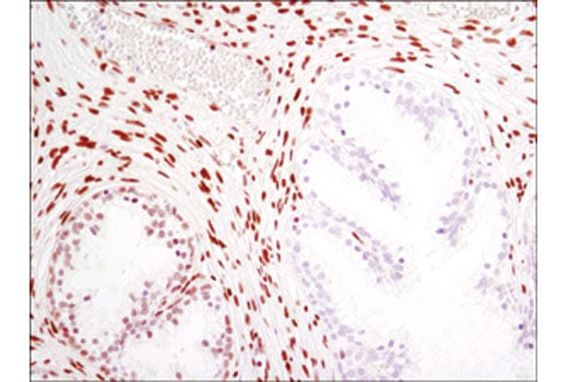 Immunohistochemistry Image 3: MeCP2 (D4F3) XP<sup>®</sup> Rabbit mAb (BSA and Azide Free)