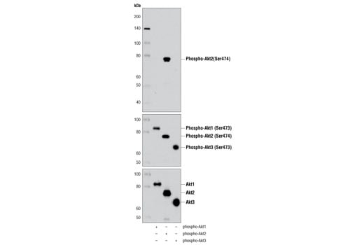 undefined Image 34: Phospho-Akt Isoform Antibody Sampler Kit