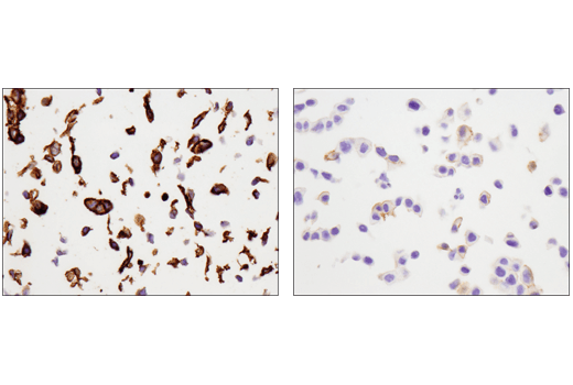 Immunohistochemistry Image 4: Tissue Factor/CD142 (E9M6T) XP<sup>®</sup> Rabbit mAb