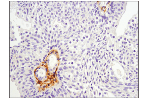Immunohistochemistry Image 4: MMP-2 (D4M2N) Rabbit mAb