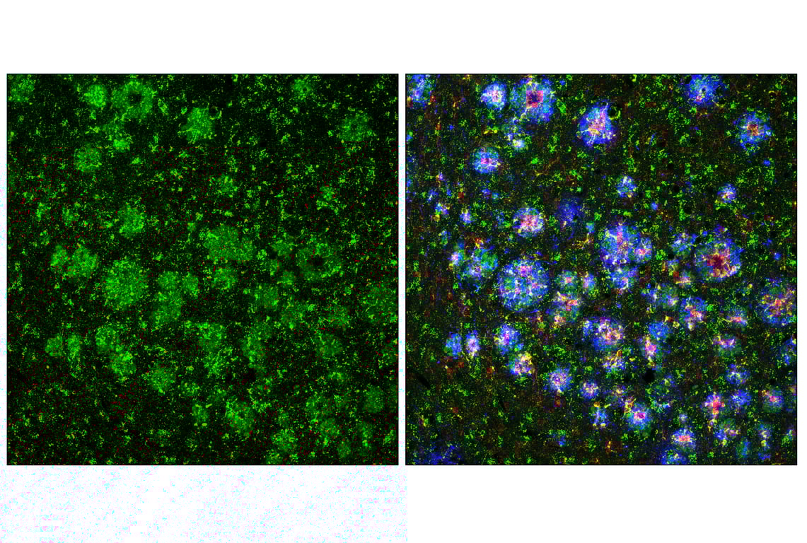Immunofluorescence Image 1: Cathepsin D (E5V4H) Rabbit mAb