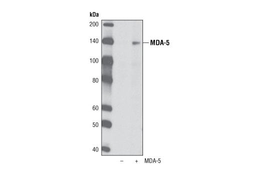 Western Blotting Image 2: MDA-5 (K375) Antibody