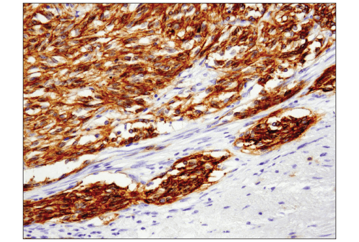 Immunohistochemistry Image 4: c-Kit (D3W6Y) XP<sup>®</sup> Rabbit mAb