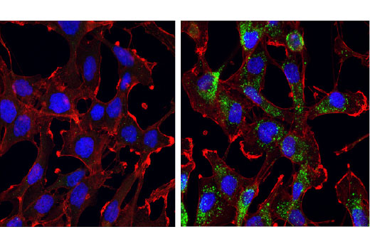 Immunofluorescence Image 1: GABARAP (E1J4E) Rabbit mAb