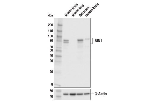 Western Blotting Image 1: BIN1 Antibody