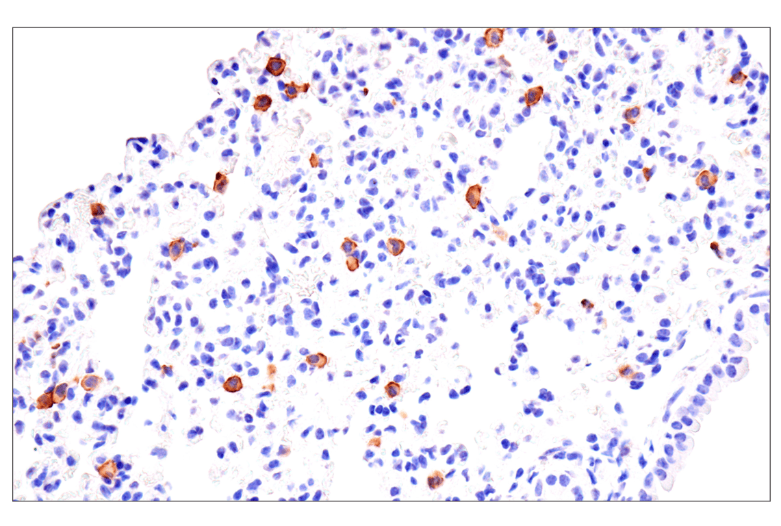 Immunohistochemistry Image 3: CD22 (F9D1W) Rabbit mAb (BSA and Azide Free)