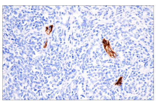 Immunohistochemistry Image 4: CD62P/P-Selectin (E8Q1W) XP<sup>®</sup> Rabbit mAb (BSA and Azide Free)