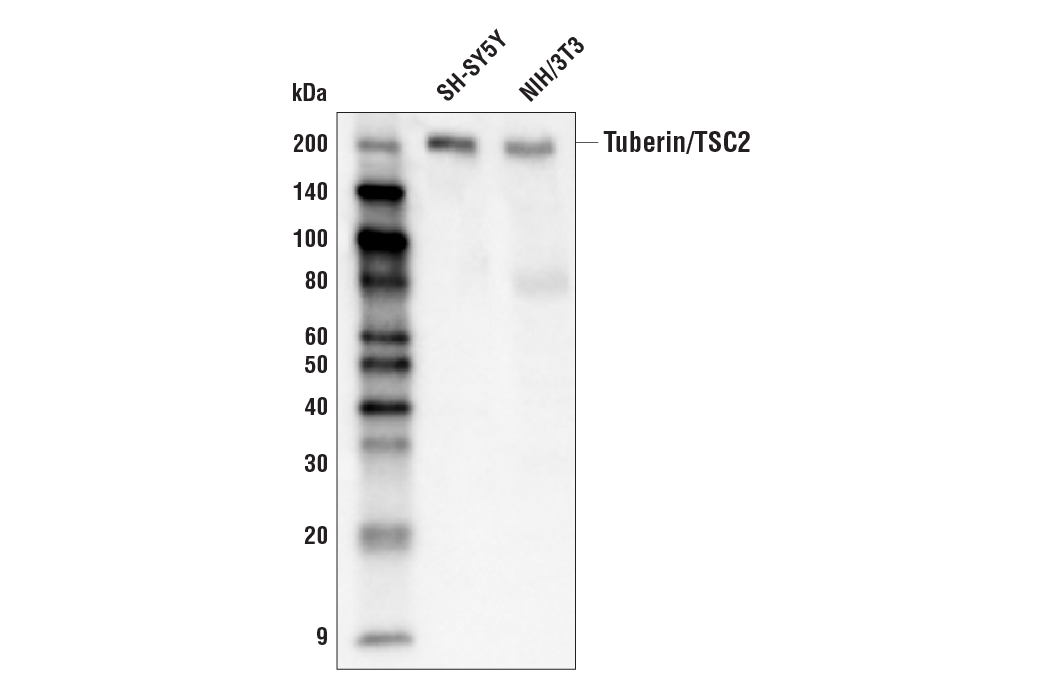 Western Blotting Image 1: Tuberin/TSC2 (D93F12) XP<sup>®</sup> Rabbit mAb (Biotinylated)