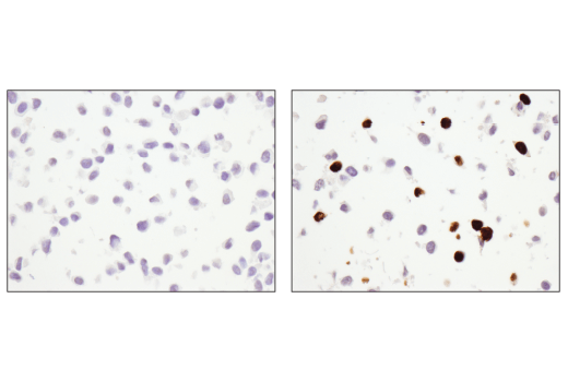 undefined Image 30: Tau Mouse Model Neuronal Viability IF Antibody Sampler Kit