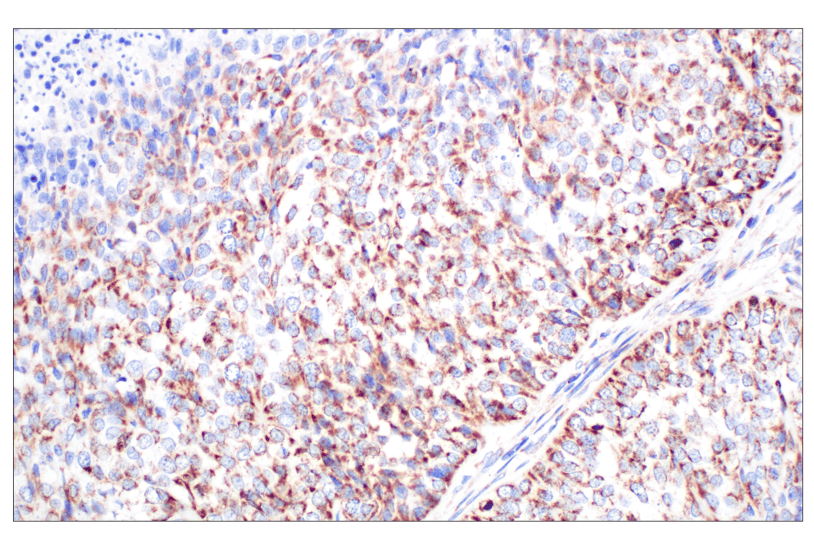 Immunohistochemistry Image 1: GCDH (F2P2M) Rabbit mAb
