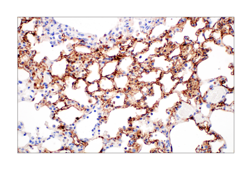 Immunohistochemistry Image 4: SARS-CoV-2 Nucleocapsid Protein (HL344) Rabbit mAb