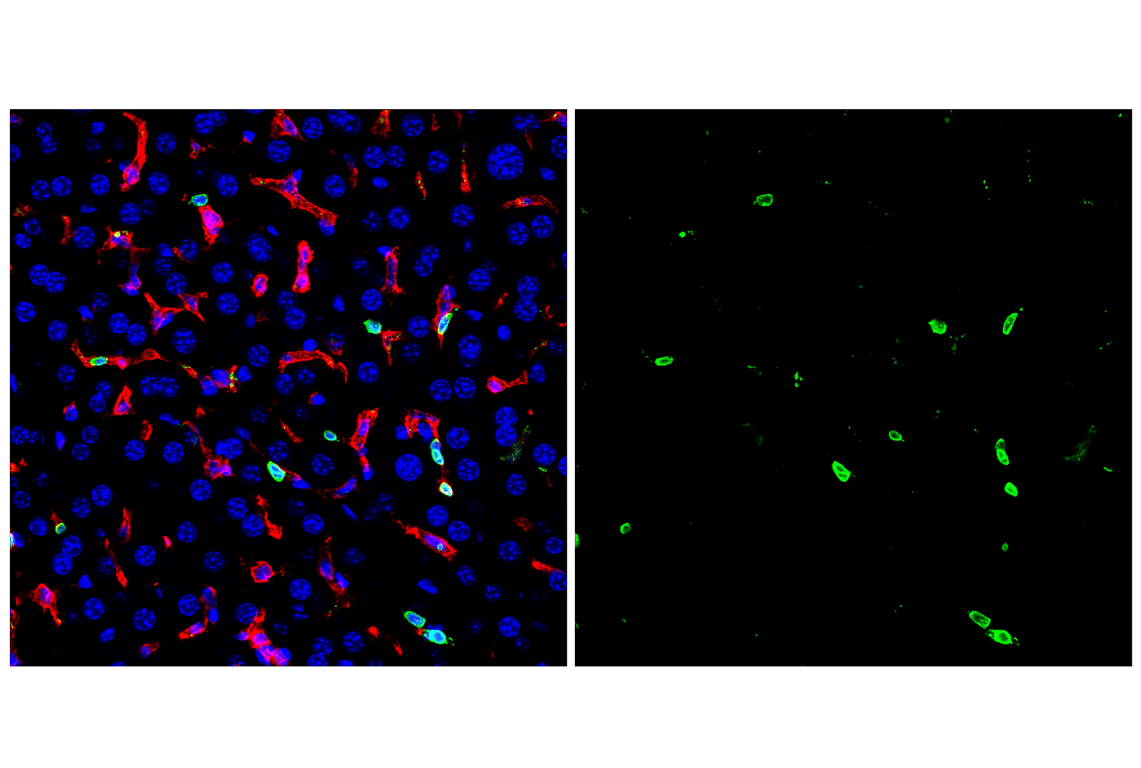 Immunofluorescence Image 2: CD20 (E3N7O) XP<sup>®</sup> Rabbit mAb (BSA and Azide Free)