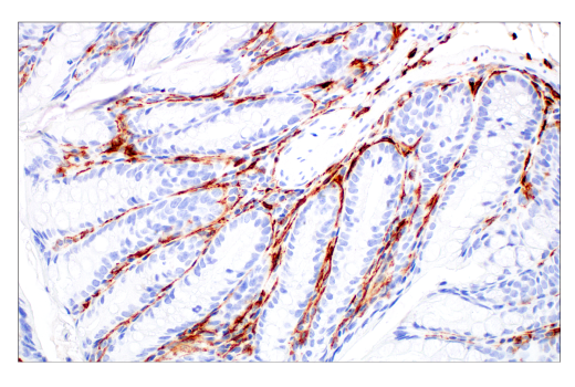 Immunohistochemistry Image 5: CD206/MRC1 (E6T5J) XP<sup>®</sup> Rabbit mAb (BSA and Azide Free)