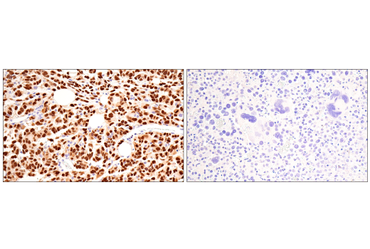 Immunohistochemistry Image 6: Olig2 (E6G6Q) XP<sup>®</sup> Rabbit mAb (BSA and Azide Free)